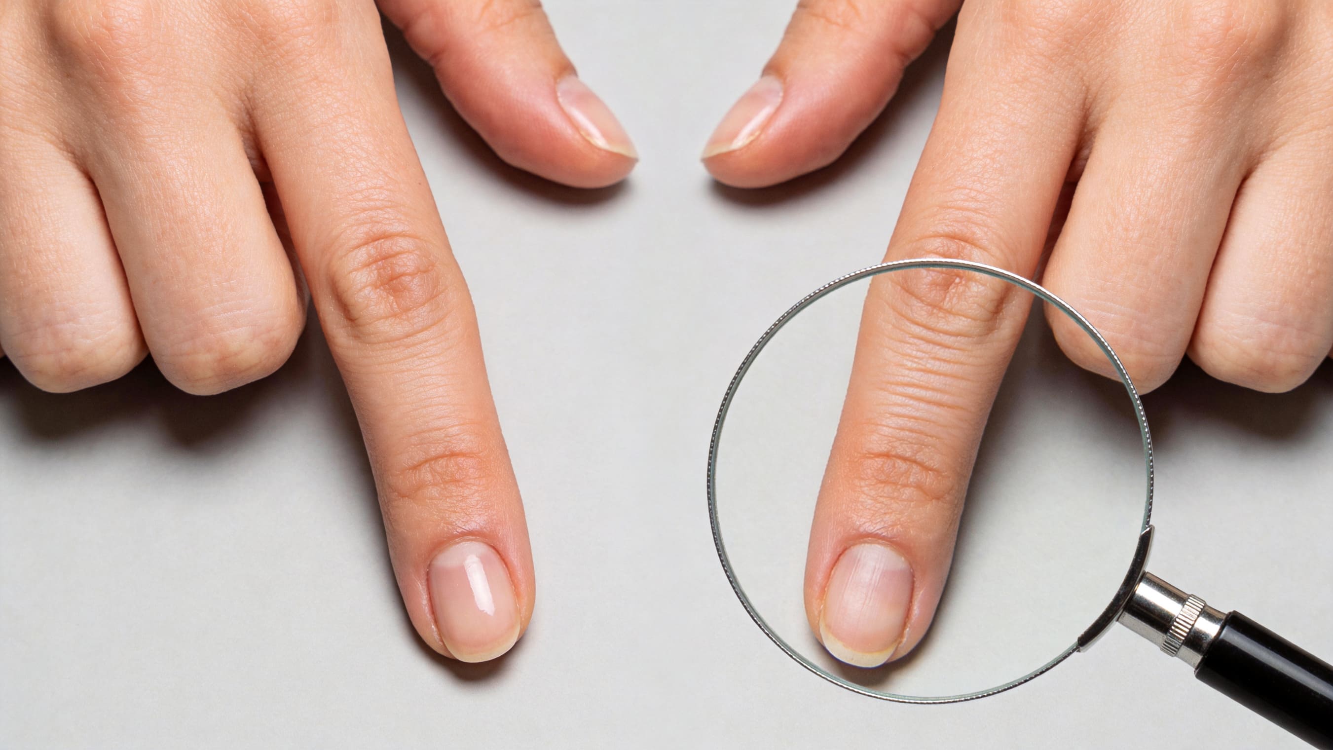 What Do Those Half-Moons and Vertical Ridges Really Mean? – Debunking Common Nail Health Myths